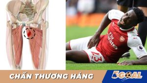 Chấn thương háng khi đá bóng: Nguyên nhân, triệu chứng & cách điều trị